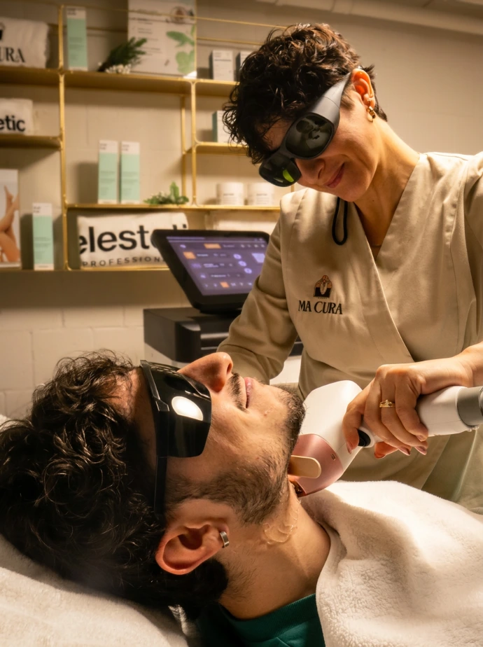 epilation laser 